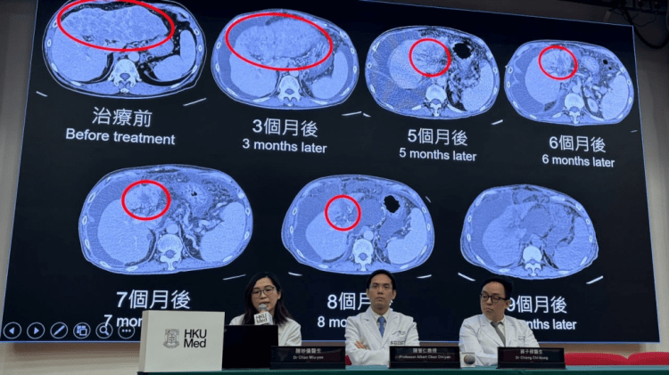 A nova terapia celular para o tratamento de câncer e outras&nbsp;doenças
